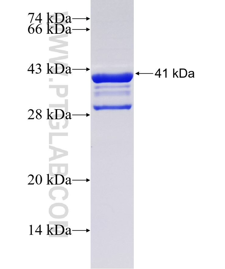 NMI fusion protein Ag34759 SDS-PAGE