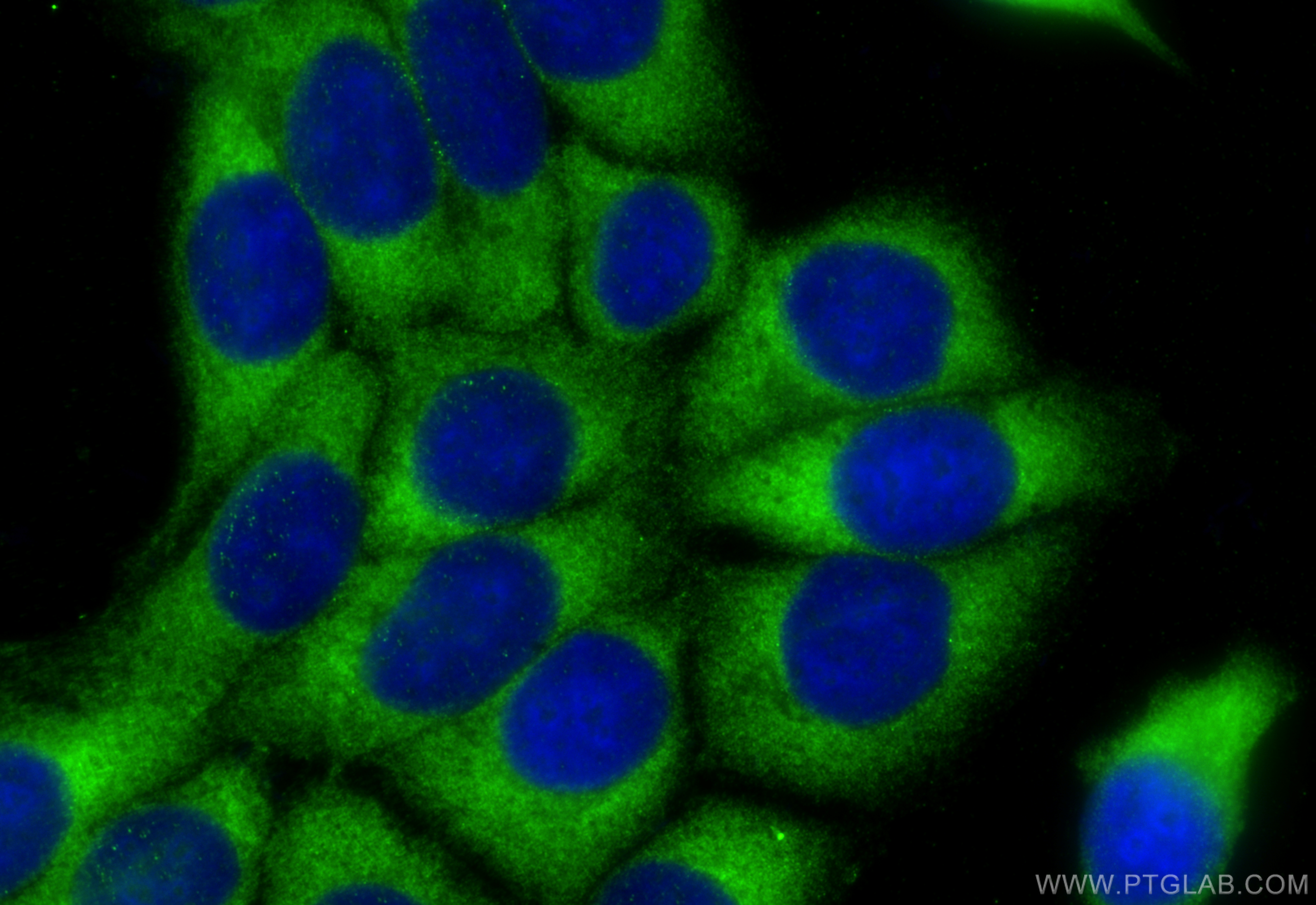 Immunofluorescence (IF) / fluorescent staining of MCF-7 cells using NMT1 Polyclonal antibody (11546-1-AP)