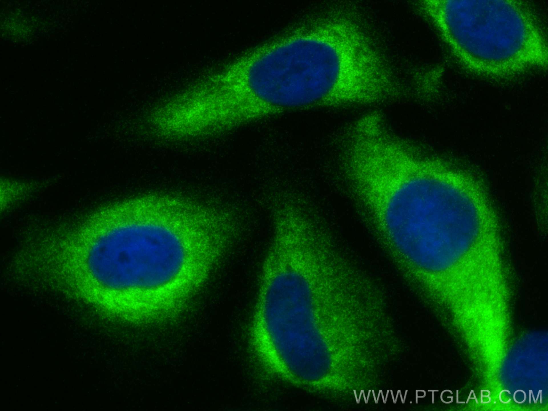 Immunofluorescence (IF) / fluorescent staining of U2OS cells using NMT2 Polyclonal antibody (15720-1-AP)