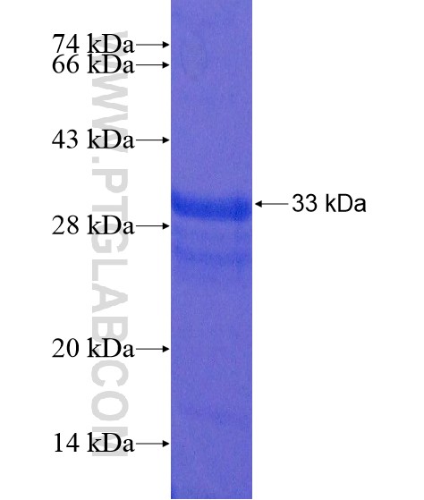 NMU fusion protein Ag21695 SDS-PAGE