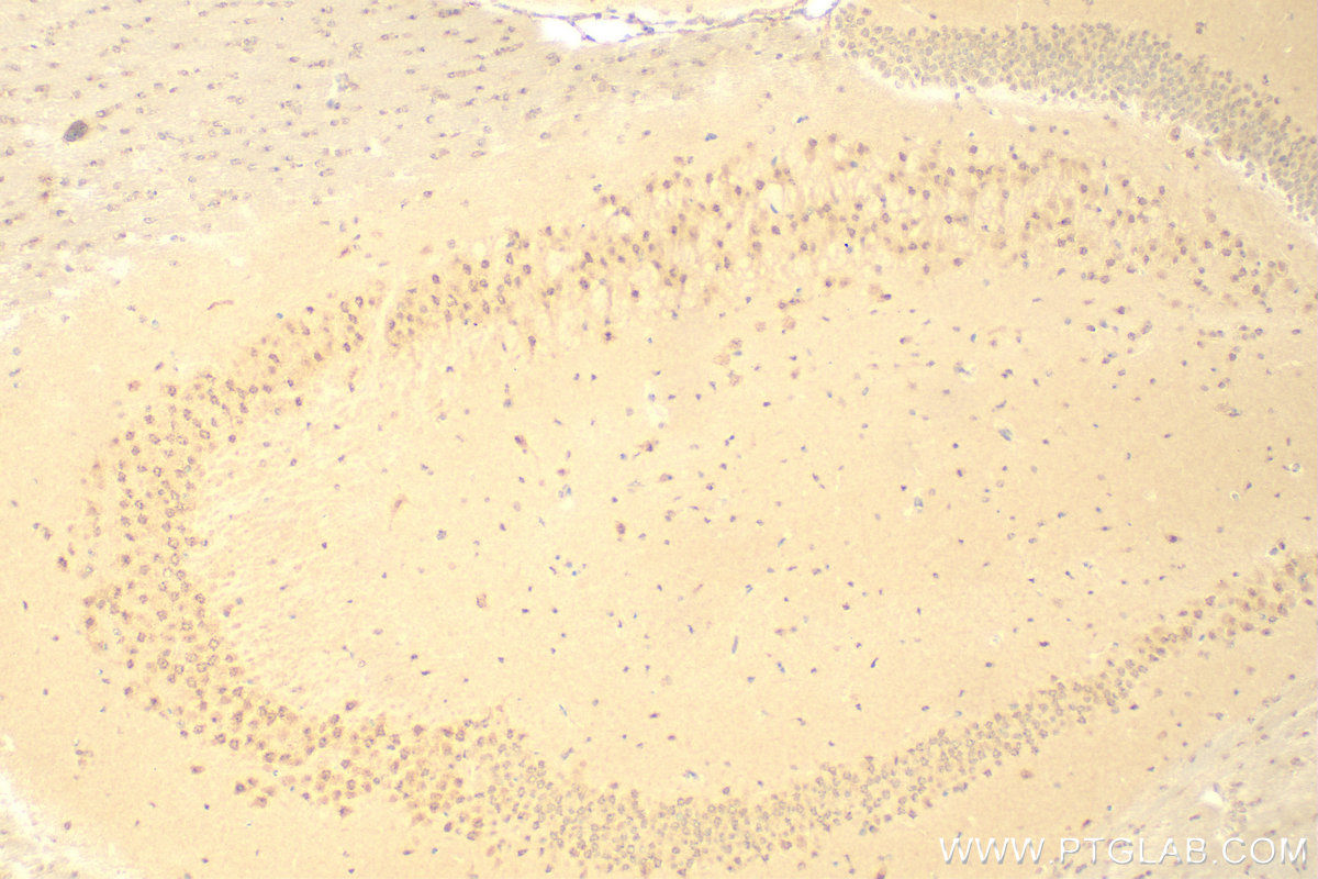 Immunohistochemistry (IHC) staining of mouse brain tissue using NOB1 Polyclonal antibody (10091-2-AP)