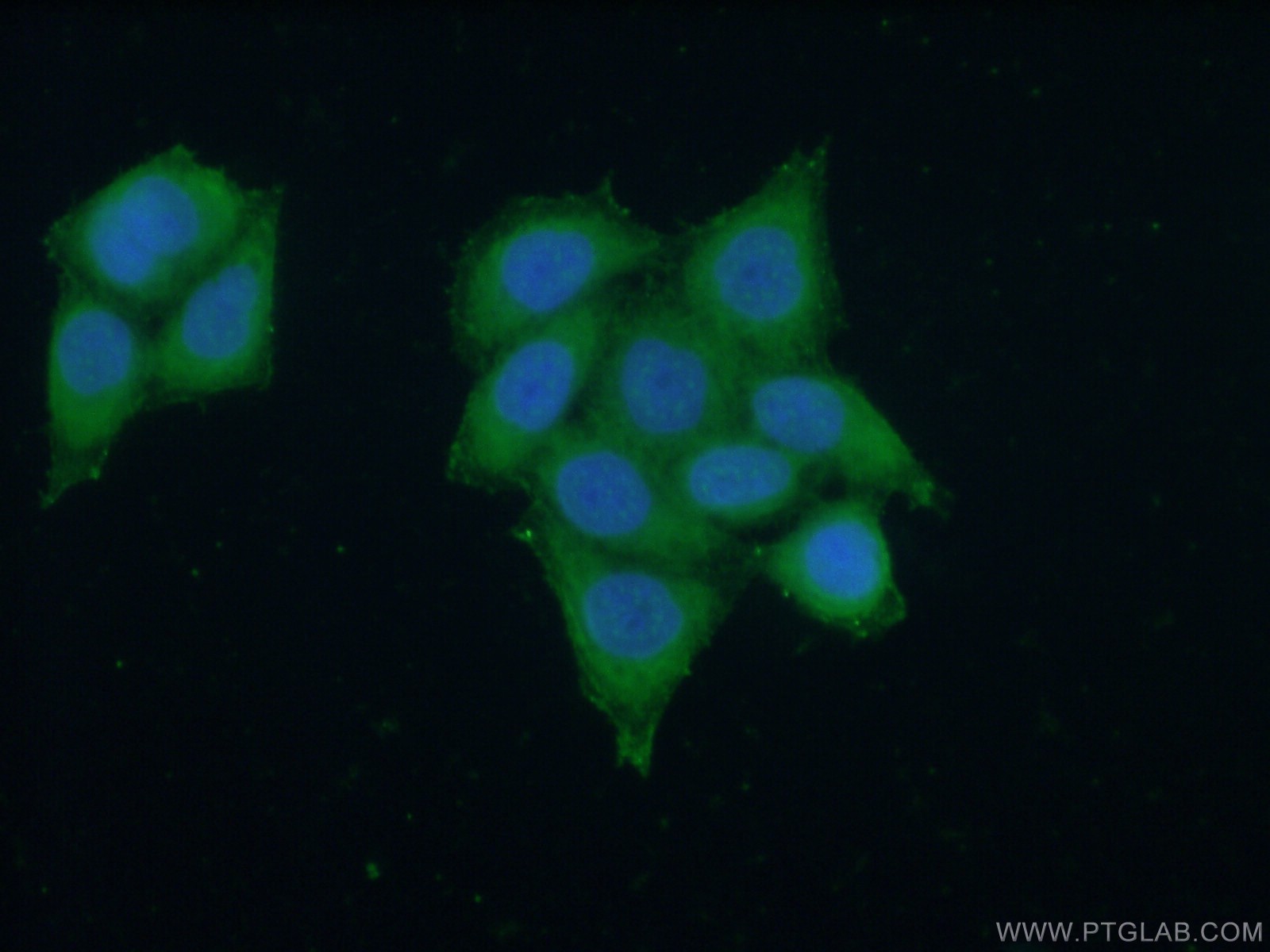 Immunofluorescence (IF) / fluorescent staining of HeLa cells using NOD2 Polyclonal antibody (20980-1-AP)