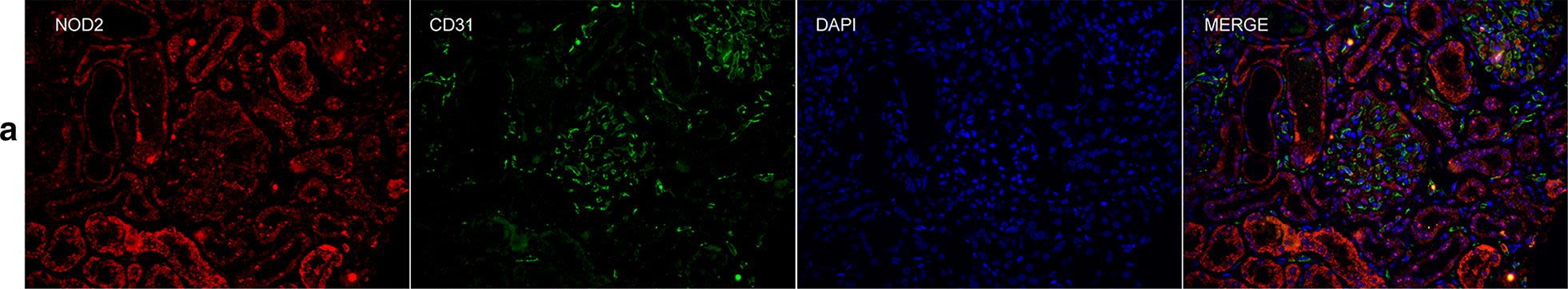 Immunofluorescence (IF) / fluorescent staining using NOD2 Polyclonal antibody (20980-1-AP)