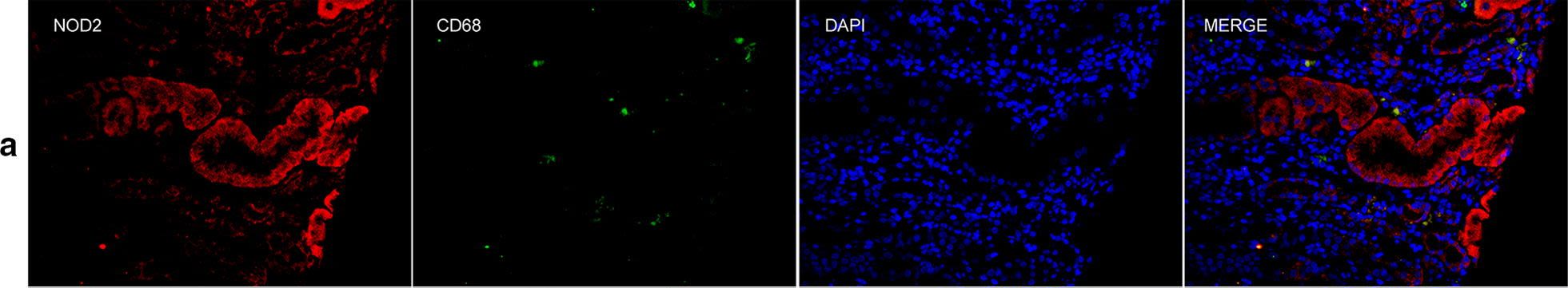 Immunofluorescence (IF) / fluorescent staining using NOD2 Polyclonal antibody (20980-1-AP)