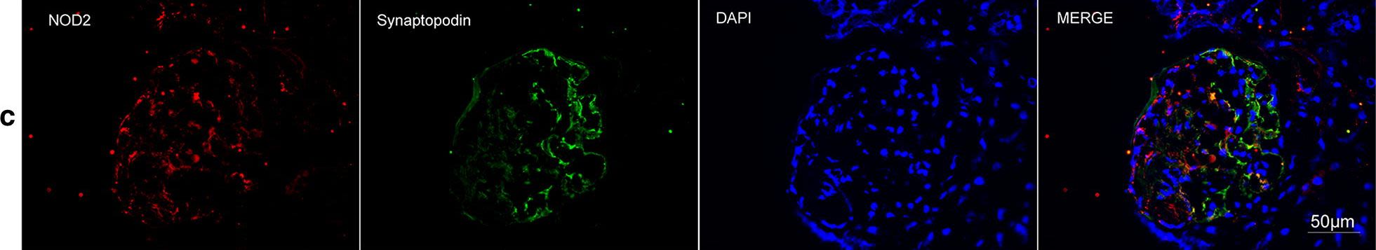 Immunofluorescence (IF) / fluorescent staining using NOD2 Polyclonal antibody (20980-1-AP)