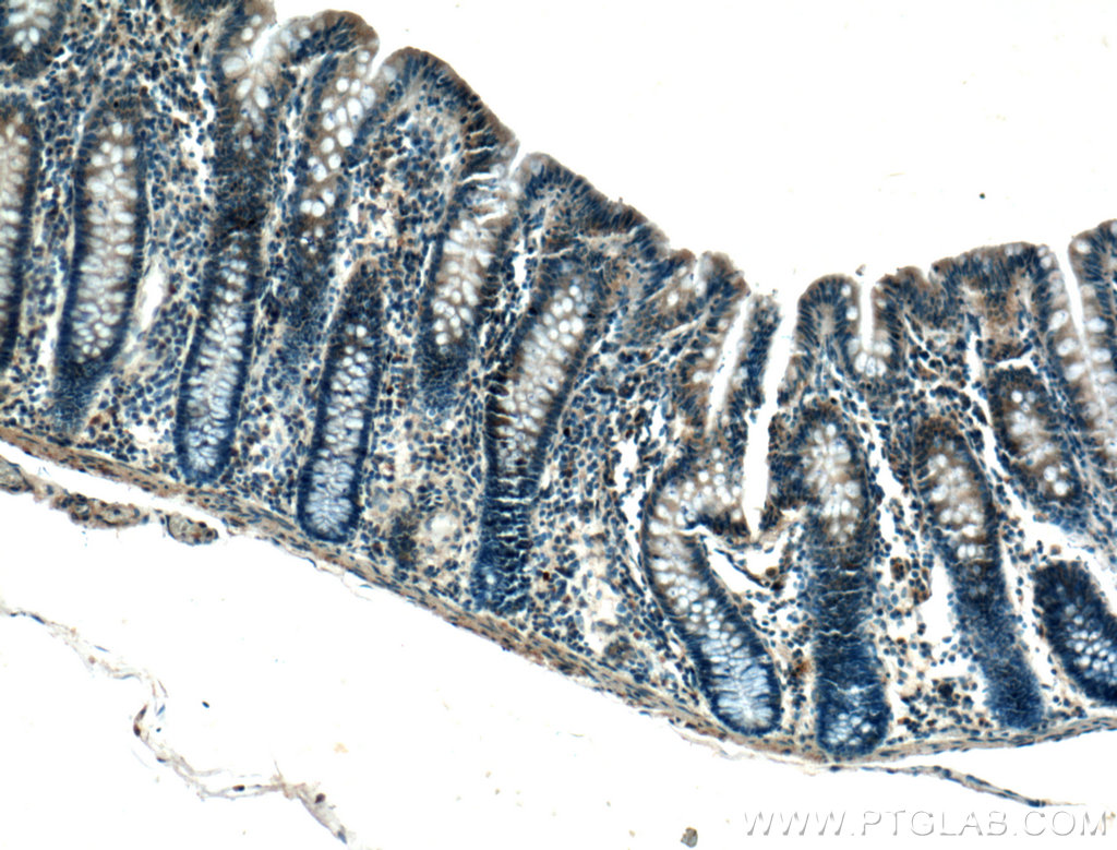 Immunohistochemistry (IHC) staining of human colon tissue using NOD2 Polyclonal antibody (20980-1-AP)