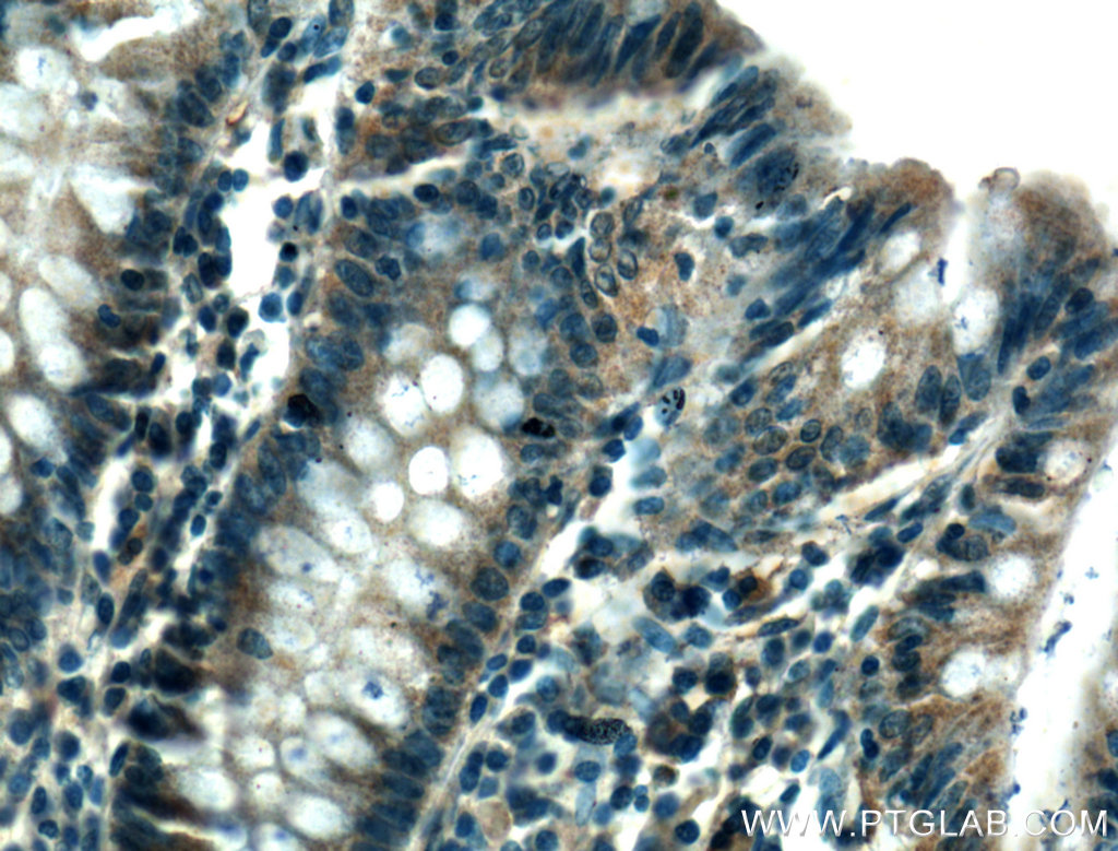 Immunohistochemistry (IHC) staining of human colon tissue using NOD2 Polyclonal antibody (20980-1-AP)