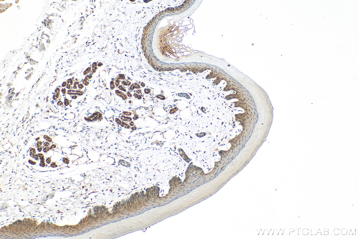 Immunohistochemistry (IHC) staining of mouse skin tissue using NOD2 Polyclonal antibody (30628-1-AP)