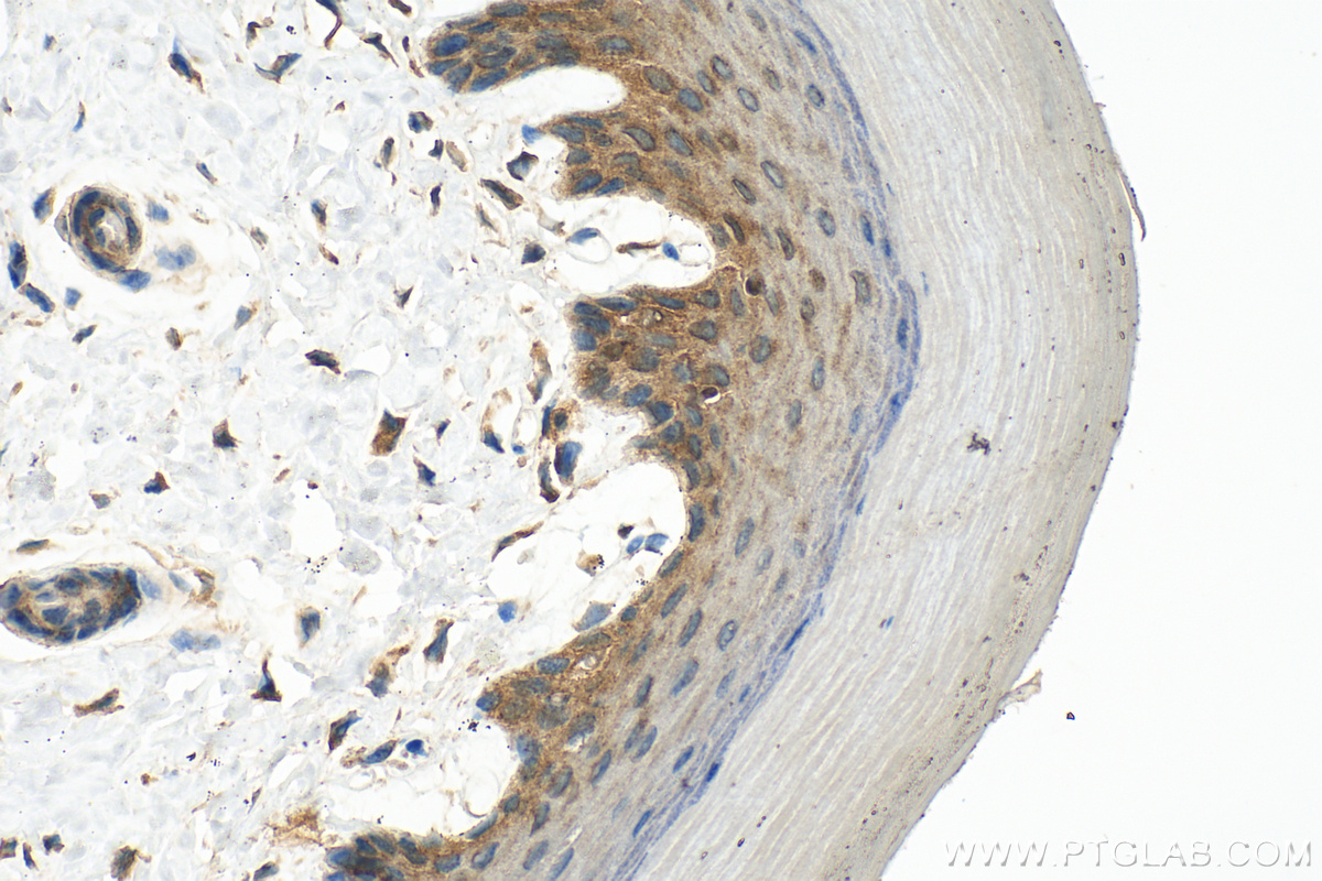 Immunohistochemistry (IHC) staining of mouse skin tissue using NOD2 Polyclonal antibody (30628-1-AP)