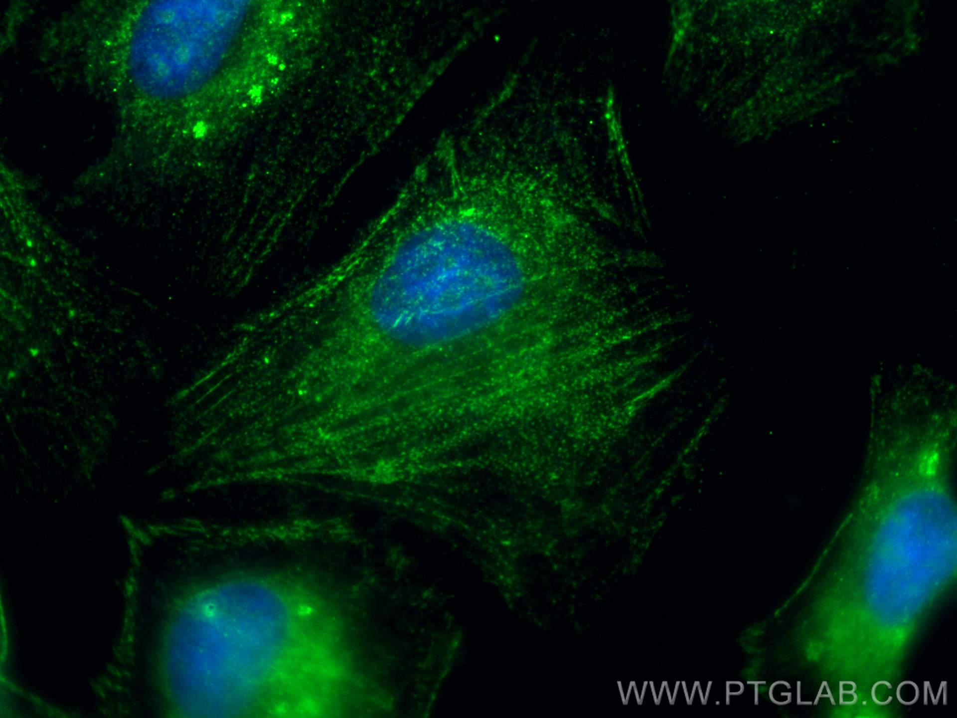 Immunofluorescence (IF) / fluorescent staining of HeLa cells using NODAL Polyclonal antibody (27430-1-AP)