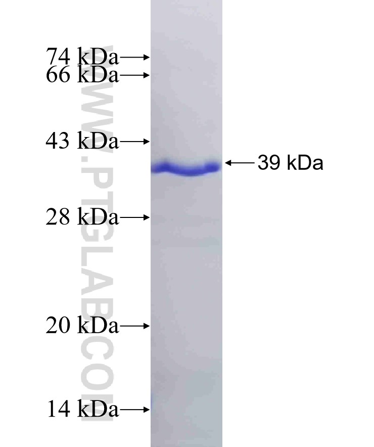 NODAL fusion protein Ag21882 SDS-PAGE