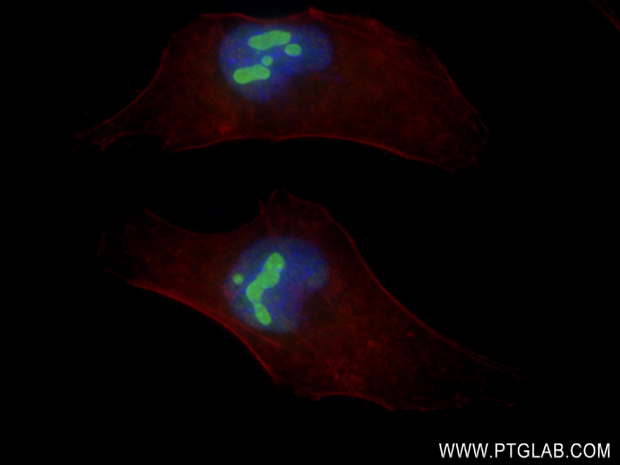 Immunofluorescence (IF) / fluorescent staining of HeLa cells using NOL11 Recombinant antibody (83391-6-RR)