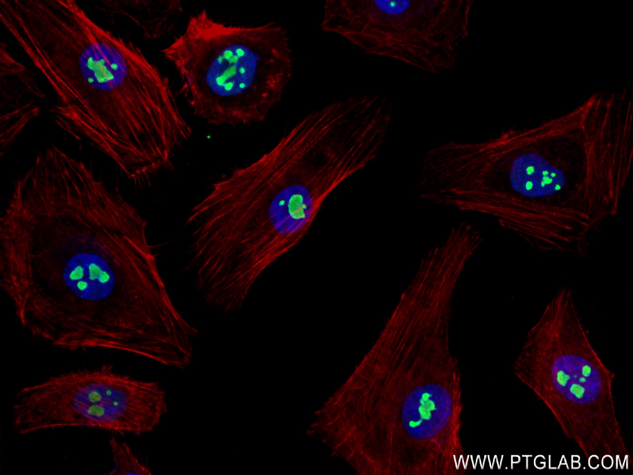 Immunofluorescence (IF) / fluorescent staining of HeLa cells using NOL11 Recombinant antibody (83391-6-RR)