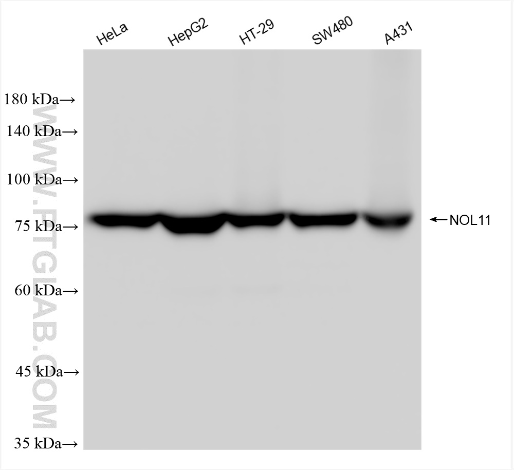 Western Blot (WB) analysis of various lysates using NOL11 Recombinant antibody (83391-6-RR)