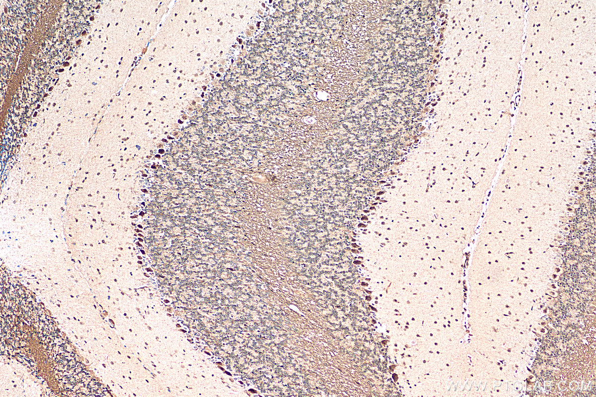 Immunohistochemistry (IHC) staining of mouse cerebellum tissue using NOM1 Polyclonal antibody (29798-1-AP)