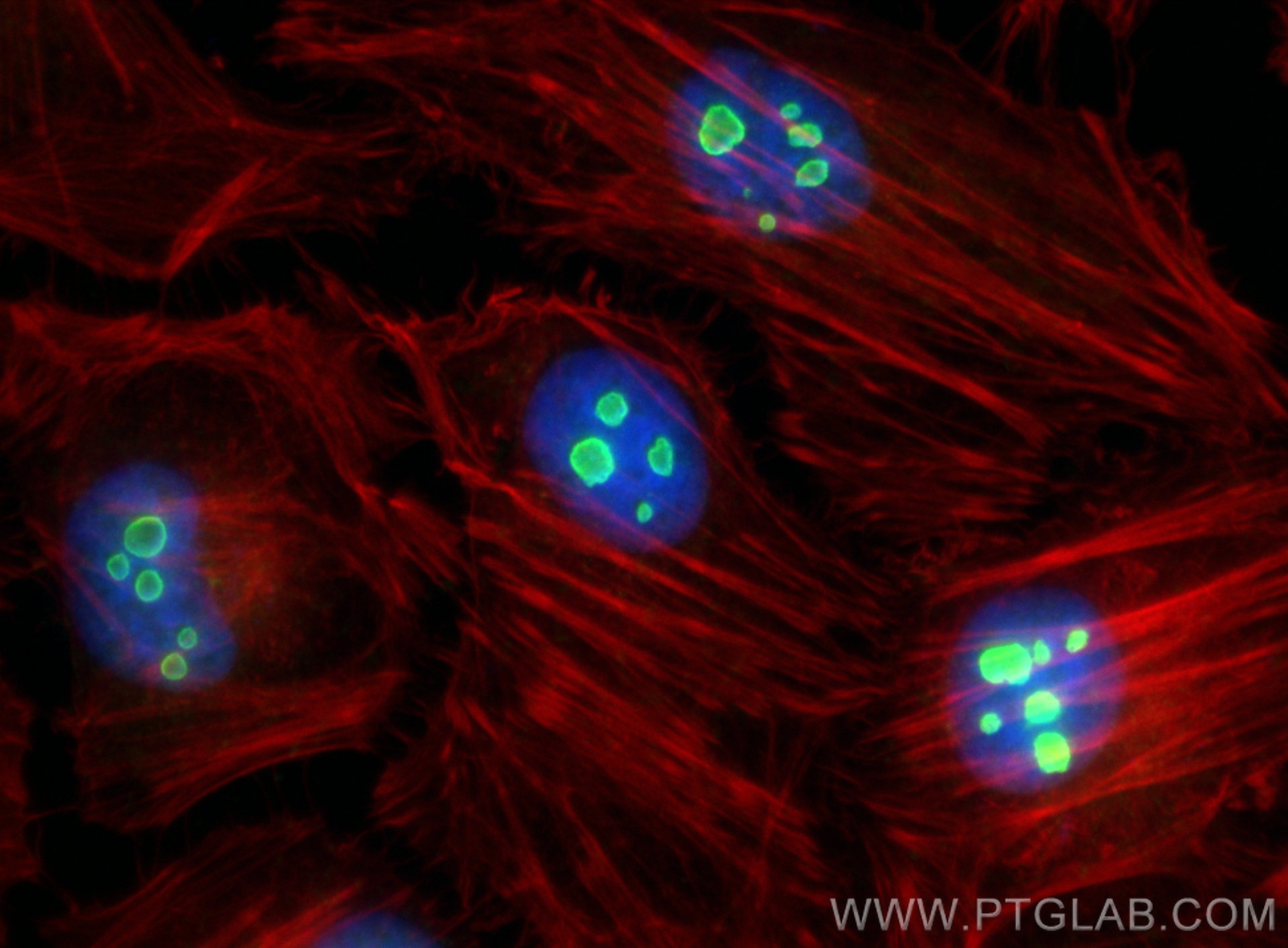 Immunofluorescence (IF) / fluorescent staining of HeLa cells using NOP2 Polyclonal antibody (10448-1-AP)