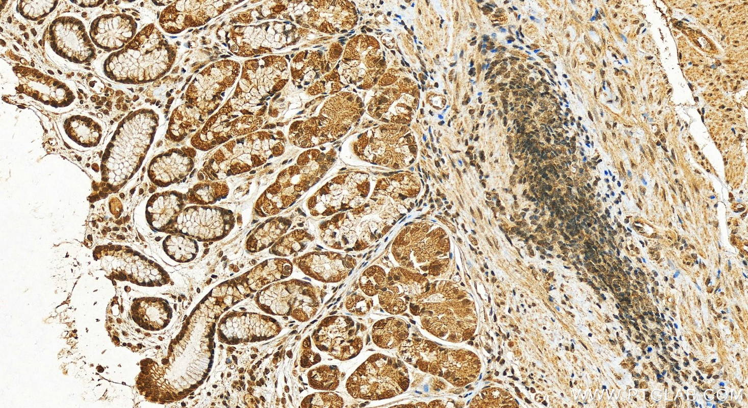 Immunohistochemistry (IHC) staining of human stomach tissue using NOP56 Polyclonal antibody (18181-1-AP)