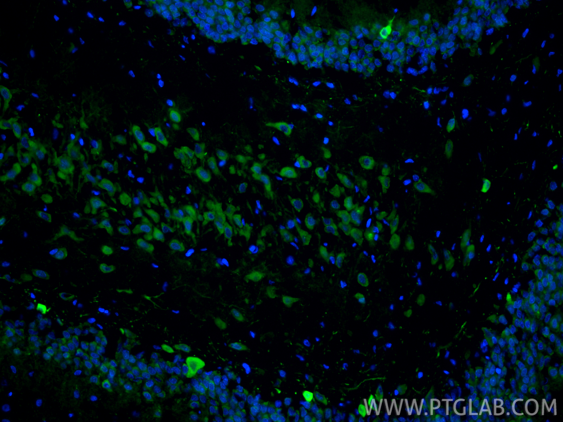 Immunofluorescence (IF) / fluorescent staining of rat brain tissue using nNOS Polyclonal antibody (29231-1-AP)