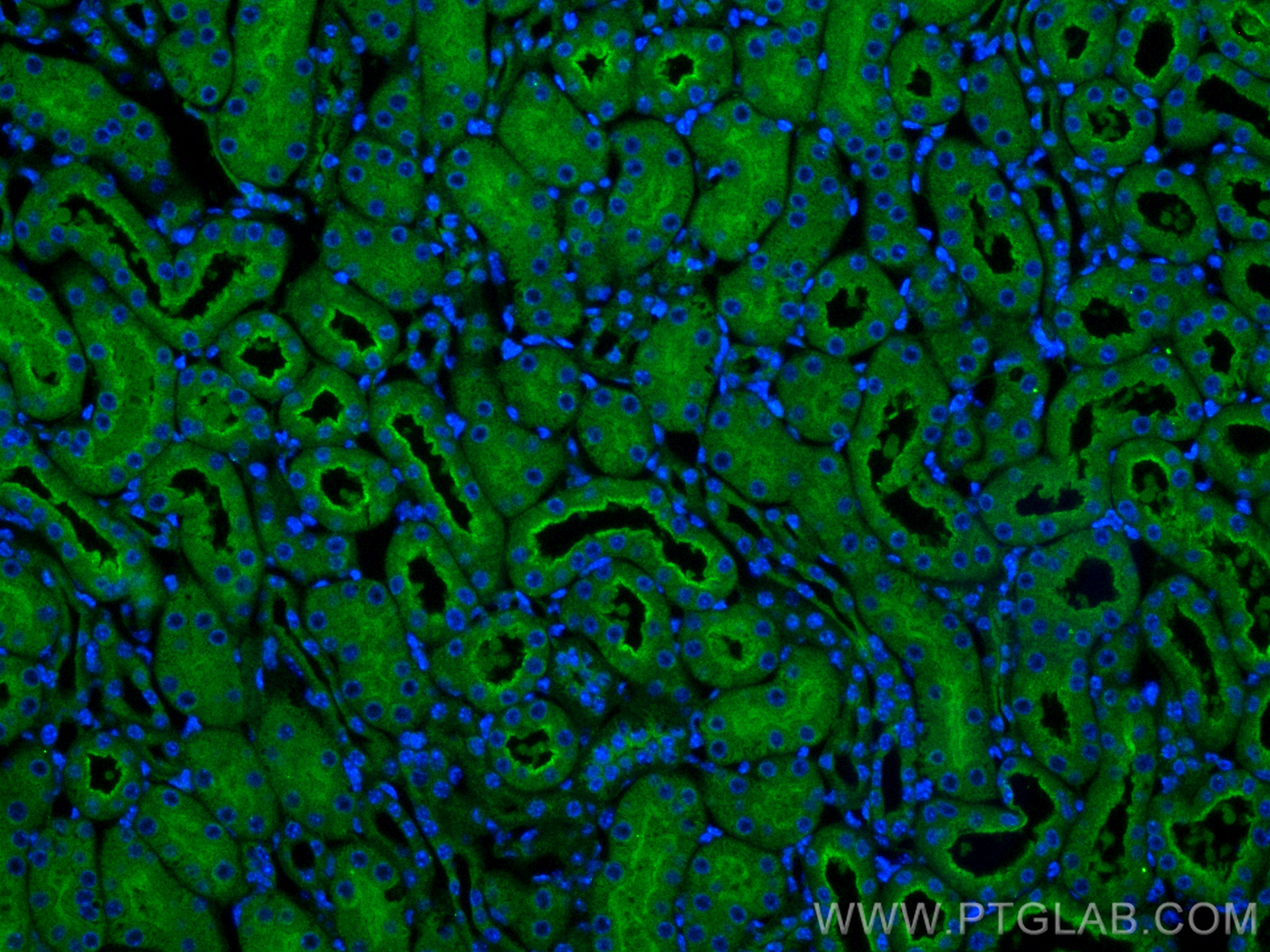 Immunofluorescence (IF) / fluorescent staining of mouse kidney tissue using NOSTRIN Polyclonal antibody (20116-1-AP)