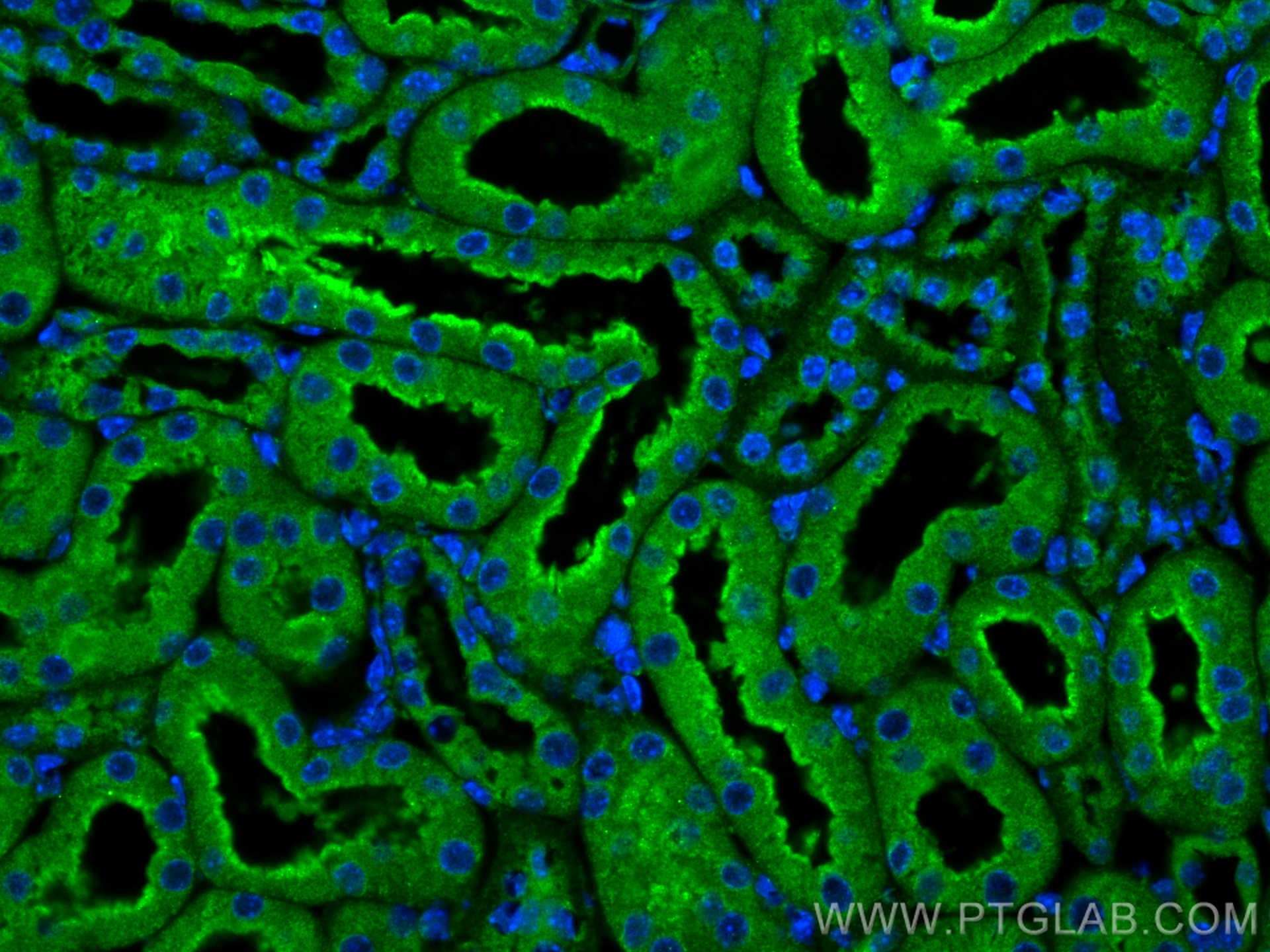 Immunofluorescence (IF) / fluorescent staining of mouse kidney tissue using NOSTRIN Polyclonal antibody (20116-1-AP)