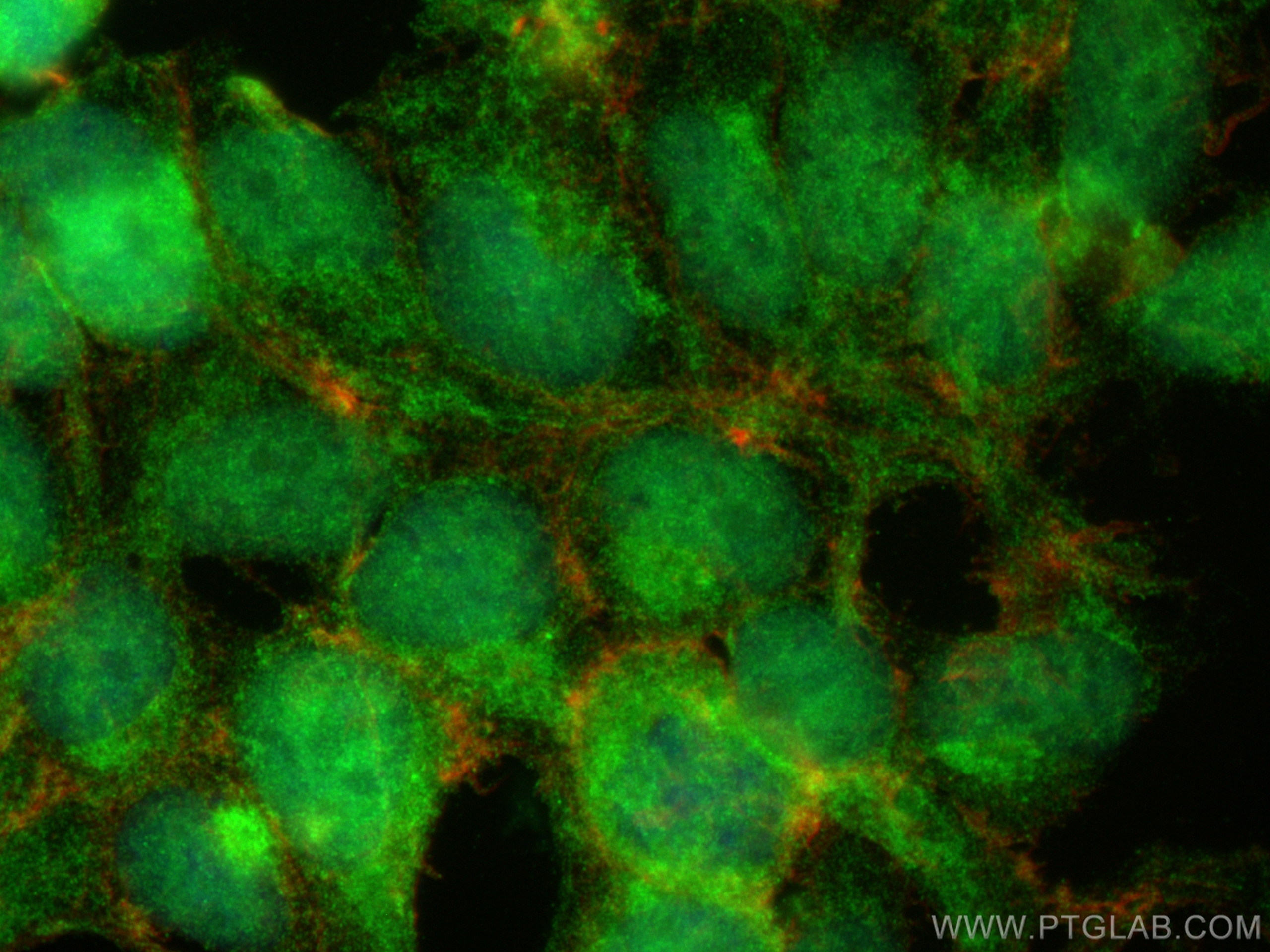 Immunofluorescence (IF) / fluorescent staining of HEK-293 cells using NOTCH2 Polyclonal antibody (28580-1-AP)