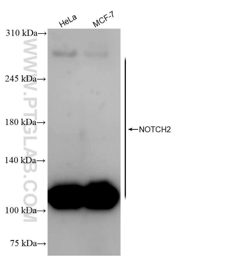 Western Blot (WB) analysis of various lysates using NOTCH2 Recombinant antibody (84074-4-RR)