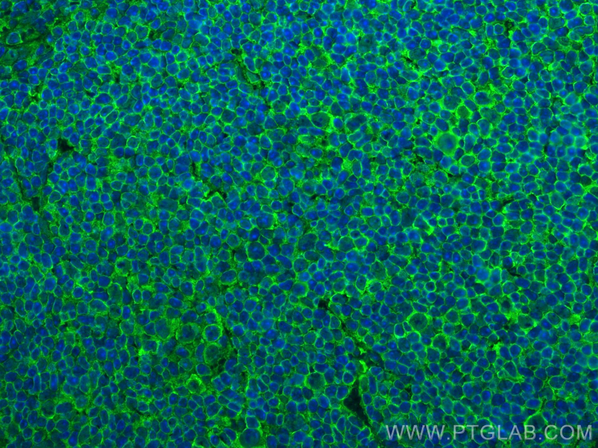 Immunofluorescence (IF) / fluorescent staining of mouse spleen tissue using NOX2 Recombinant antibody (82872-1-RR)