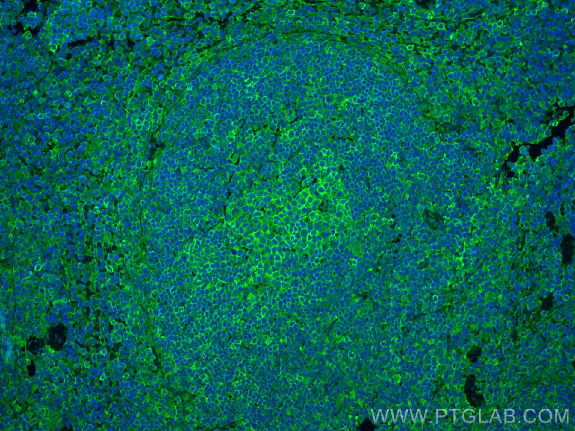 Immunofluorescence (IF) / fluorescent staining of mouse spleen tissue using NOX2 Recombinant antibody (82872-1-RR)