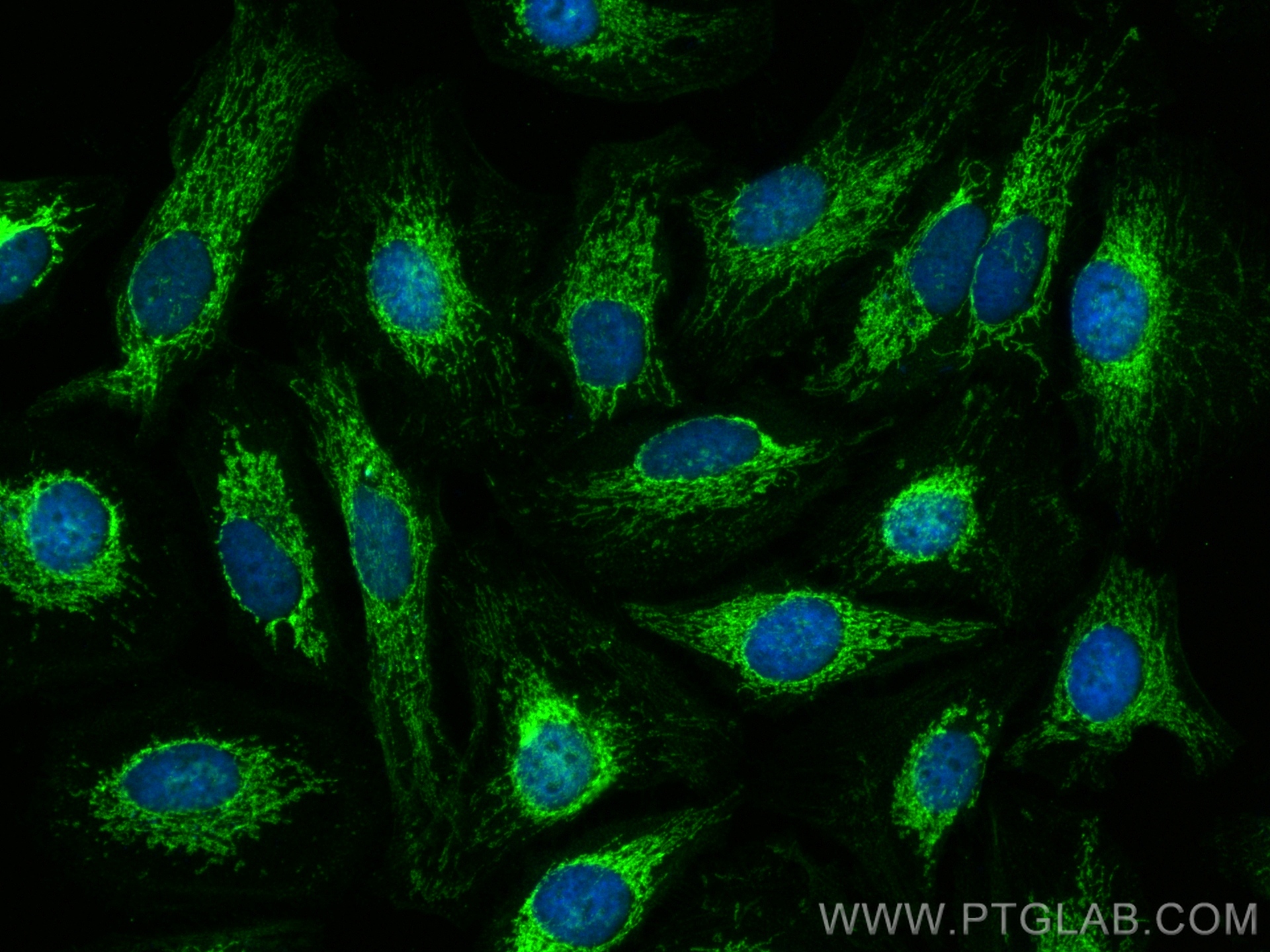 Immunofluorescence (IF) / fluorescent staining of HeLa cells using NOX4 Polyclonal antibody (14347-1-AP)