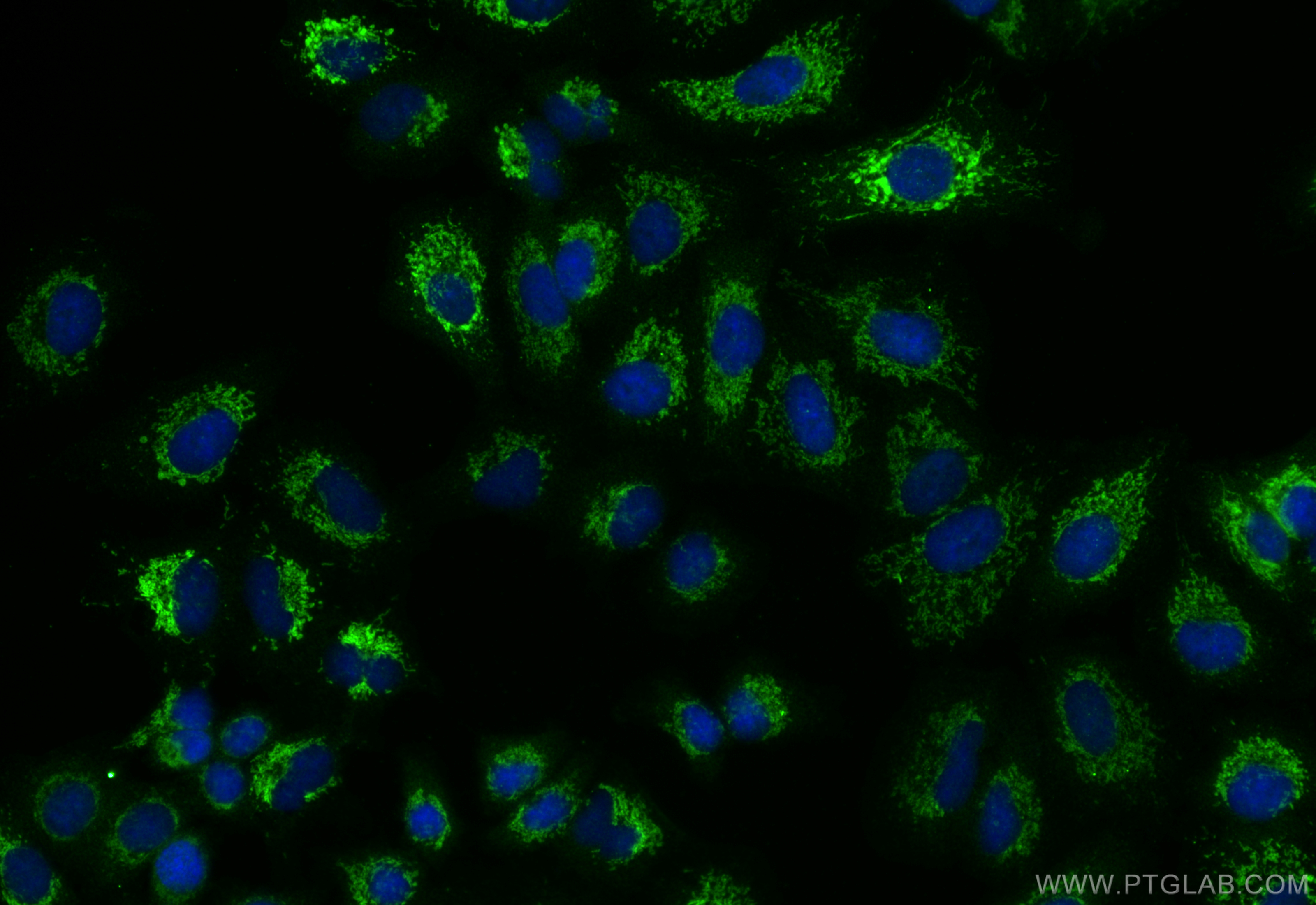 Immunofluorescence (IF) / fluorescent staining of A549 cells using NOX4 Polyclonal antibody (14347-1-AP)