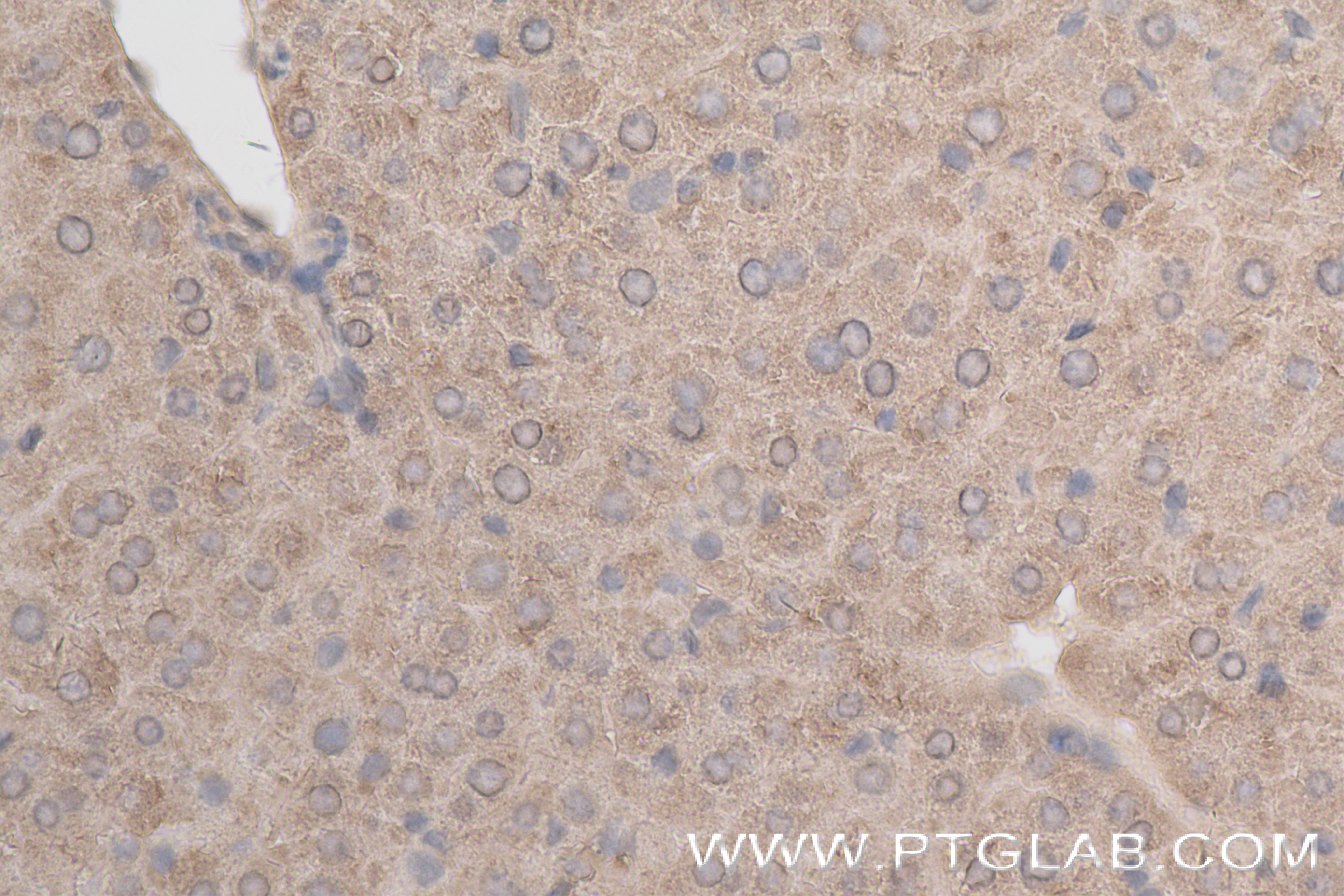 Immunohistochemistry (IHC) staining of mouse liver tissue using NPEPPS Recombinant antibody (84230-4-RR)