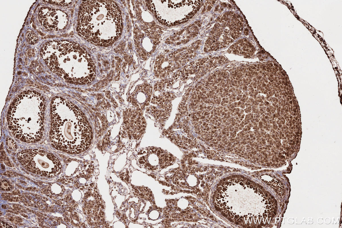 Immunohistochemistry (IHC) staining of mouse ovary tissue using NPHP3 Polyclonal antibody (22026-1-AP)