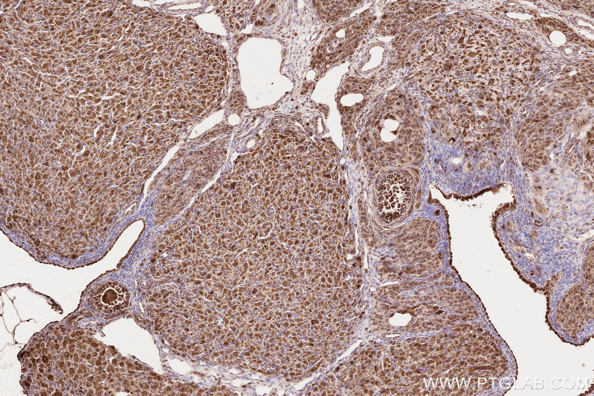Immunohistochemistry (IHC) staining of rat ovary tissue using NPHP3 Polyclonal antibody (22026-1-AP)