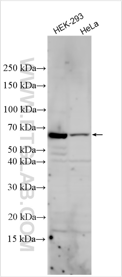 Western Blot (WB) analysis of various lysates using NPHP5/IQCB1 Polyclonal antibody (15747-1-AP)