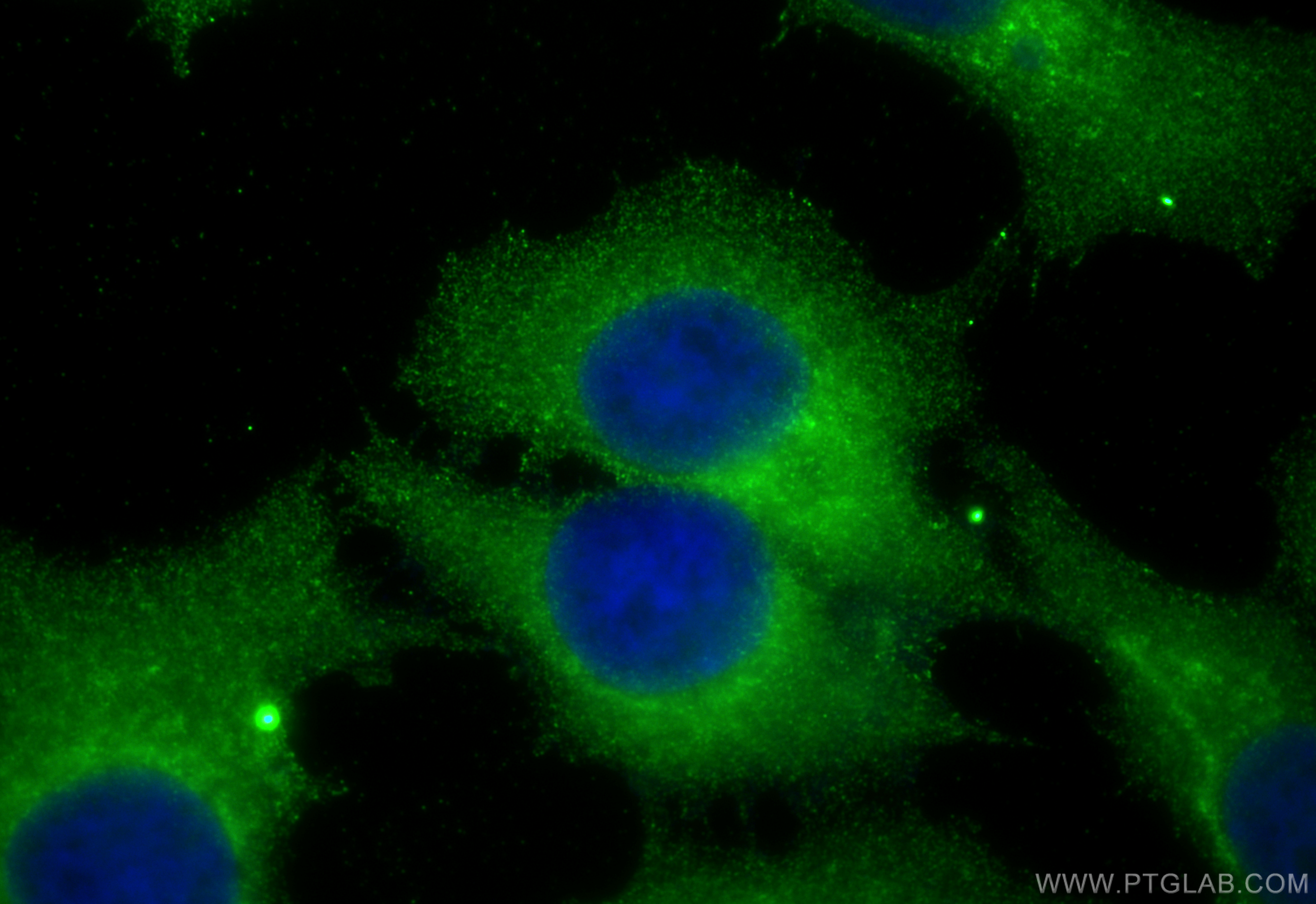 Immunofluorescence (IF) / fluorescent staining of MCF-7 cells using NPL Polyclonal antibody (16715-1-AP)