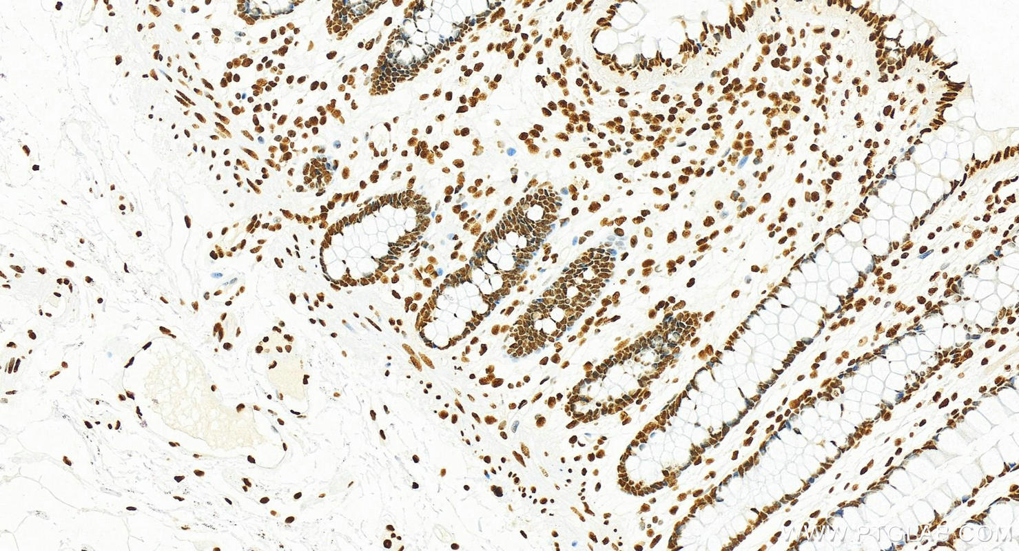 Immunohistochemistry (IHC) staining of human normal colon using B23/NPM1 Polyclonal antibody (10306-1-AP)