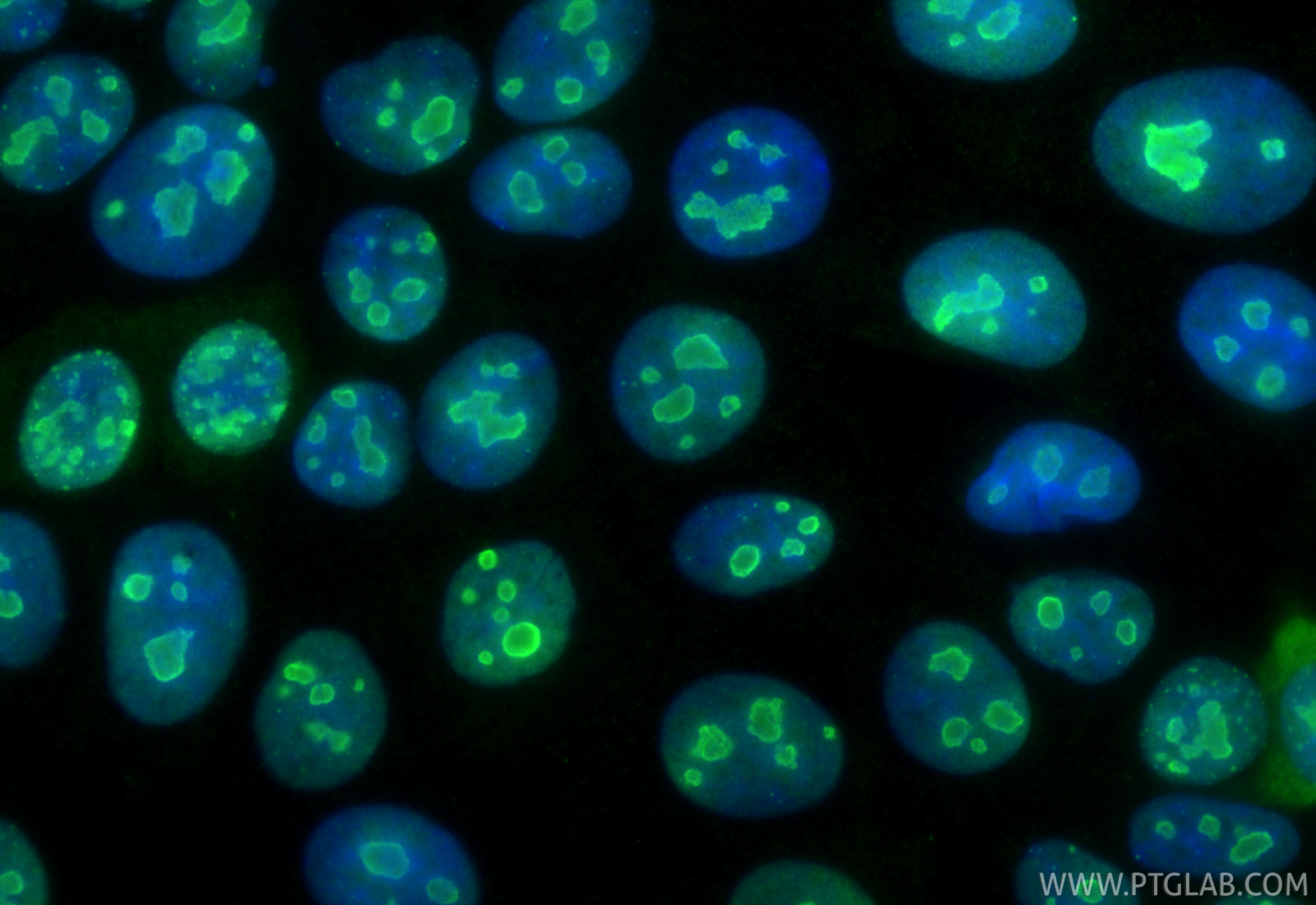 Immunofluorescence (IF) / fluorescent staining of MCF-7 cells using B23/NPM1 Monoclonal antibody (60096-1-Ig)