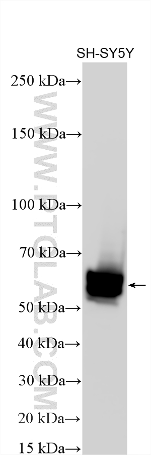 Western Blot (WB) analysis of various lysates using NPTX2 Polyclonal antibody (10889-1-AP)