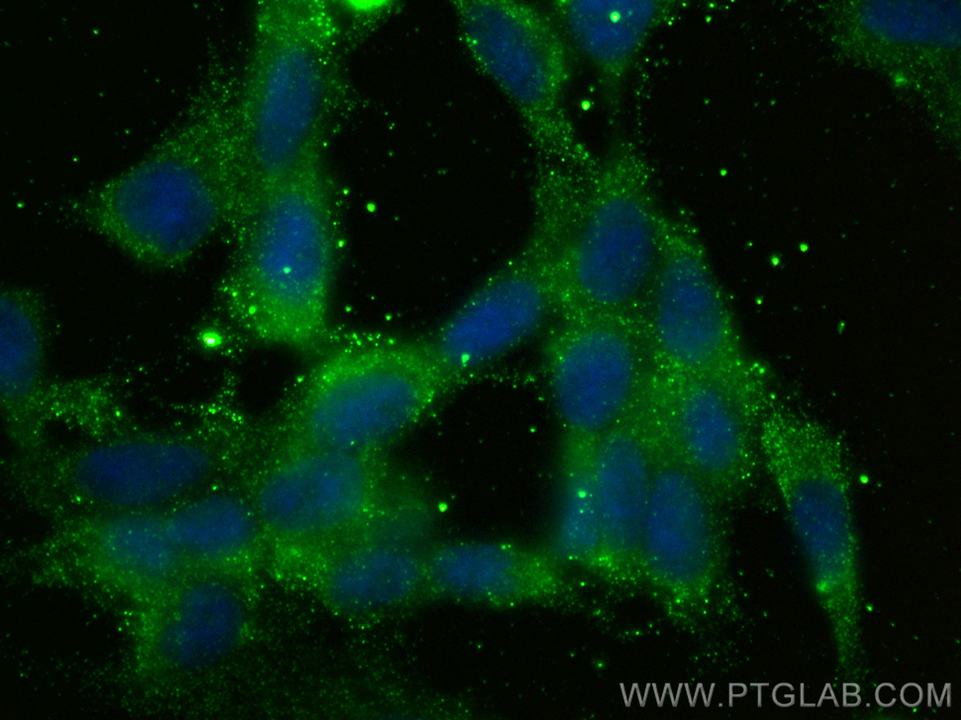 Immunofluorescence (IF) / fluorescent staining of SH-SY5Y cells using NPTX2 Monoclonal antibody (68709-1-Ig)