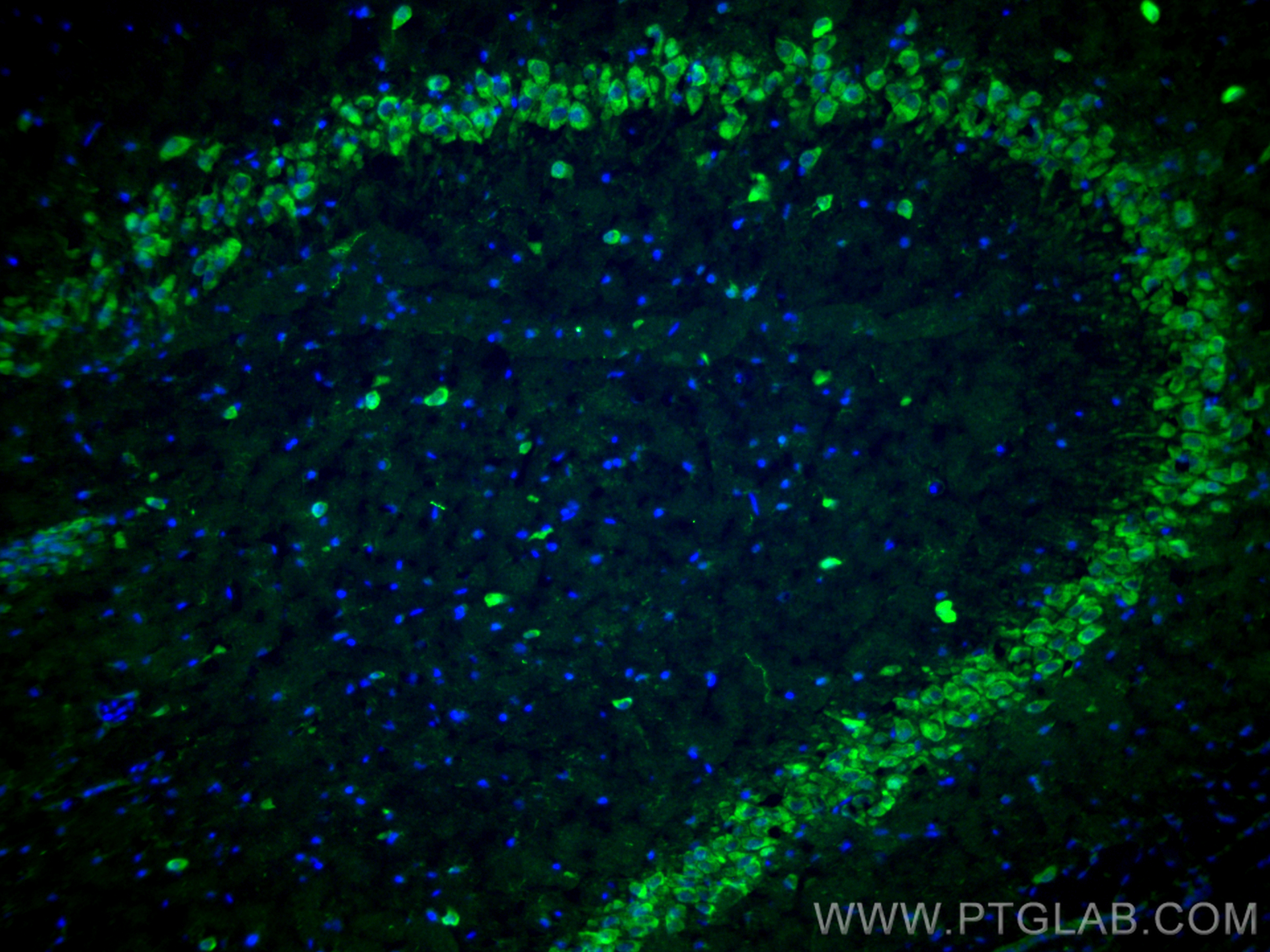 Immunofluorescence (IF) / fluorescent staining of rat brain tissue using Neuropeptide Y Polyclonal antibody (12833-1-AP)