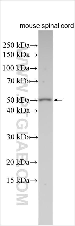 Western Blot (WB) analysis of various lysates using NPY5R Polyclonal antibody (30848-1-AP)