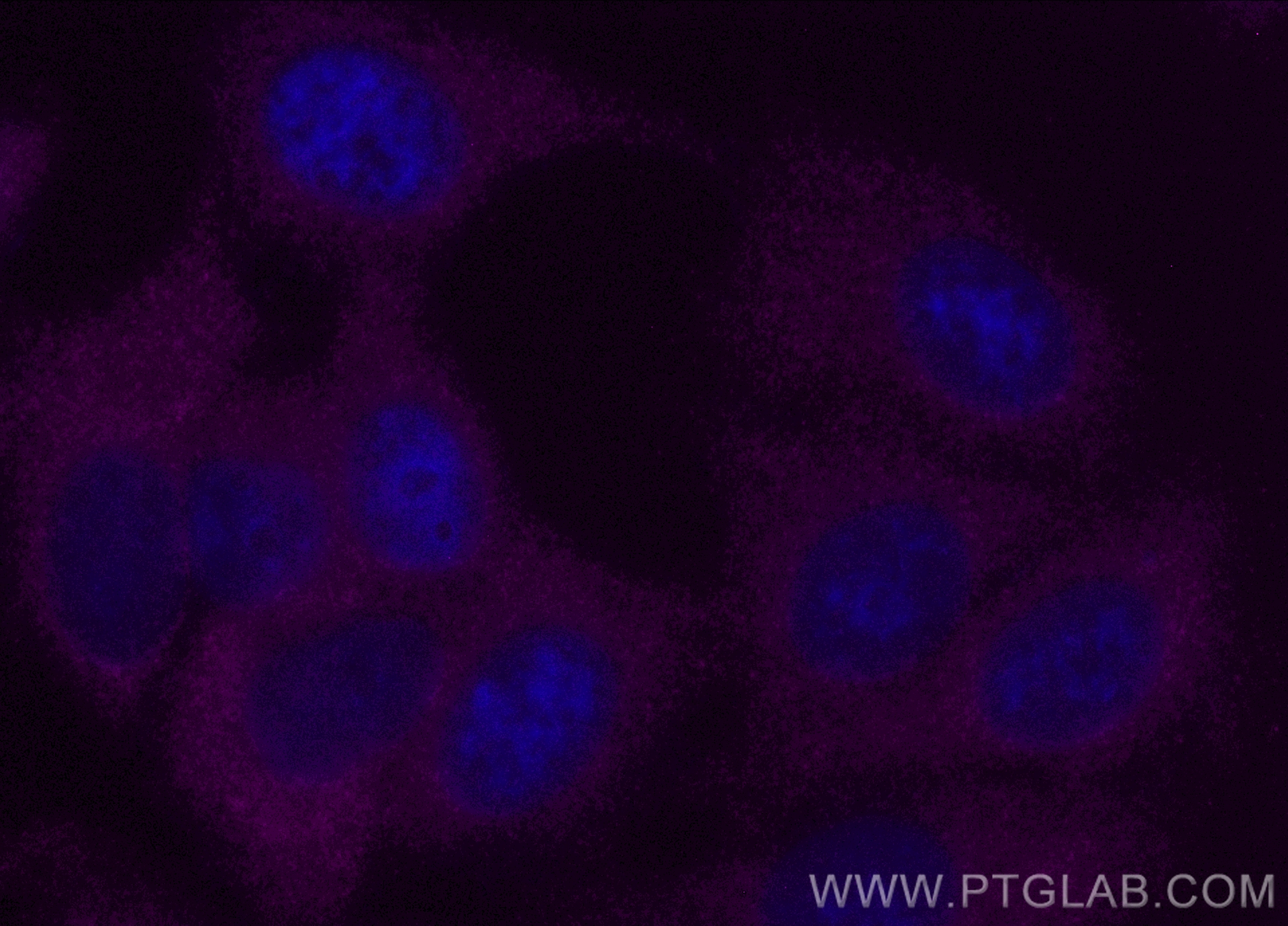 Immunofluorescence (IF) / fluorescent staining of MCF-7 cells using CoraLite® Plus 647-conjugated NQO1 Polyclonal anti (CL647-11451)