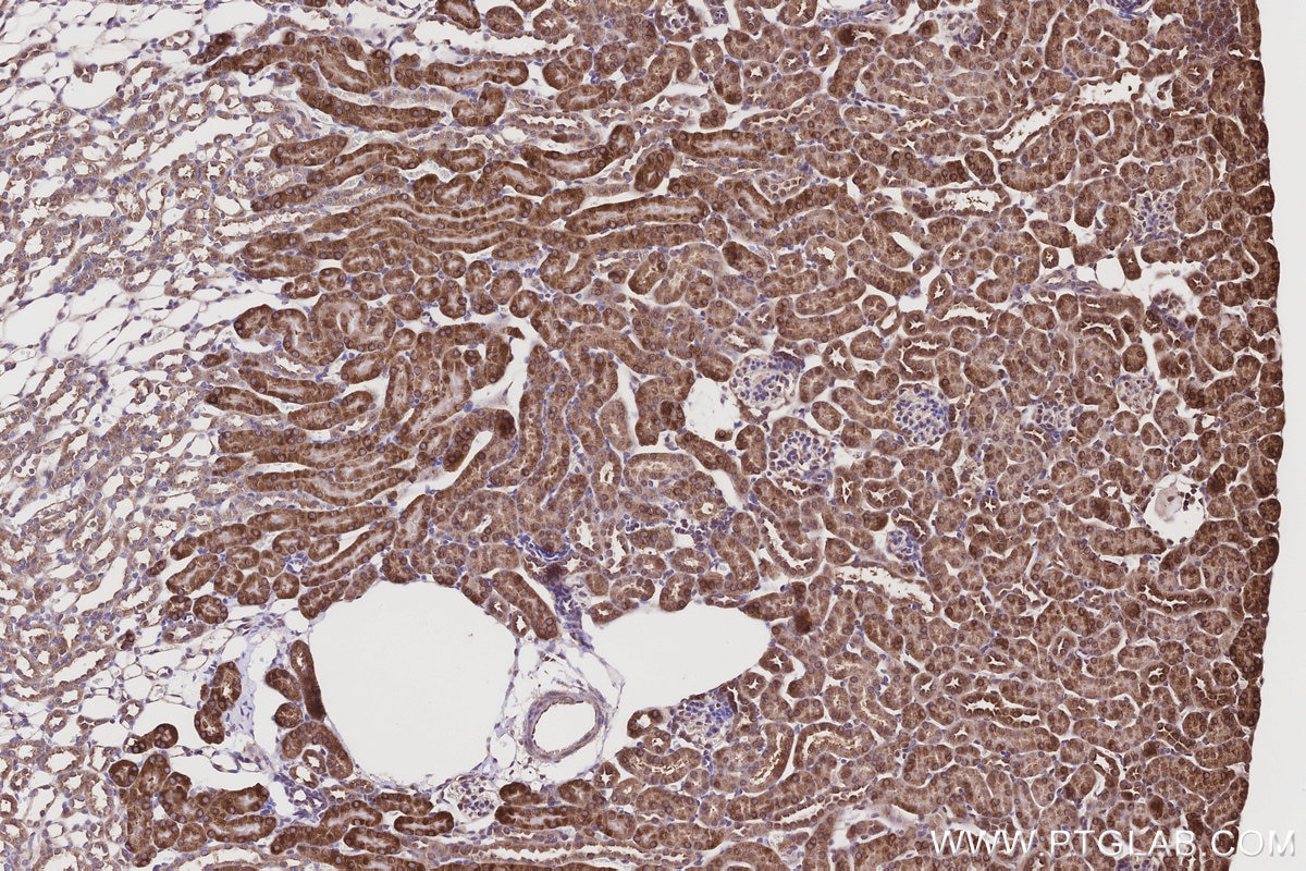 Immunohistochemistry (IHC) staining of mouse kidney tissue using NQO2 Polyclonal antibody (15767-1-AP)
