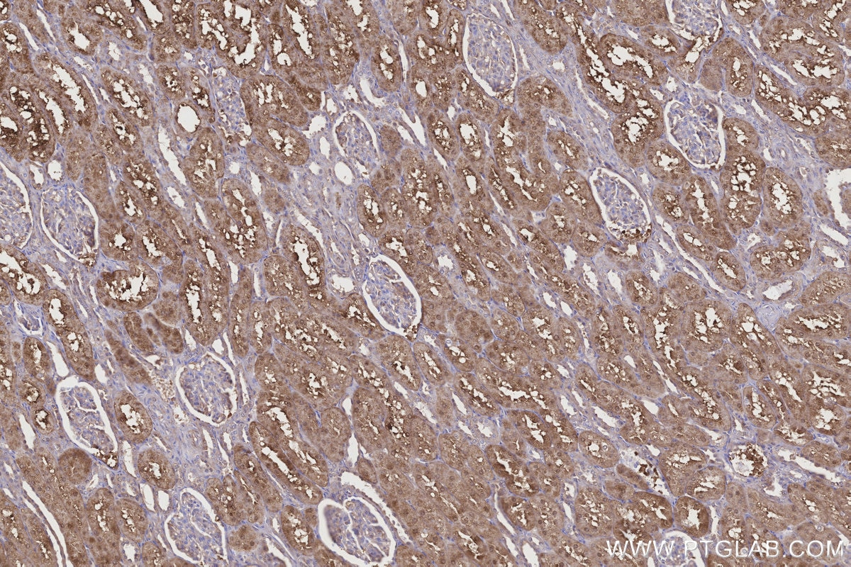 Immunohistochemistry (IHC) staining of human kidney tissue using NQO2 Polyclonal antibody (15767-1-AP)