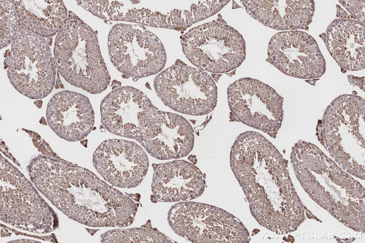 Immunohistochemistry (IHC) staining of mouse testis tissue using NQO2 Polyclonal antibody (15767-1-AP)
