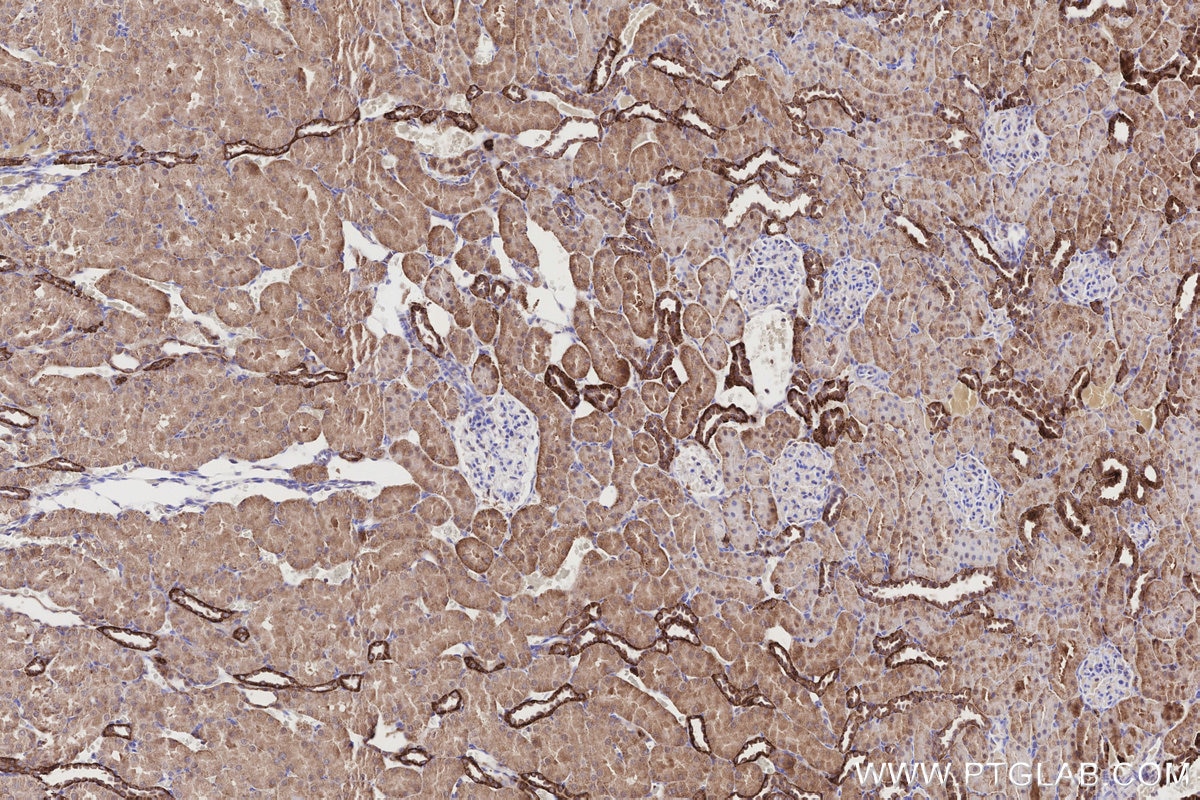 Immunohistochemistry (IHC) staining of rat kidney tissue using NQO2 Polyclonal antibody (15767-1-AP)