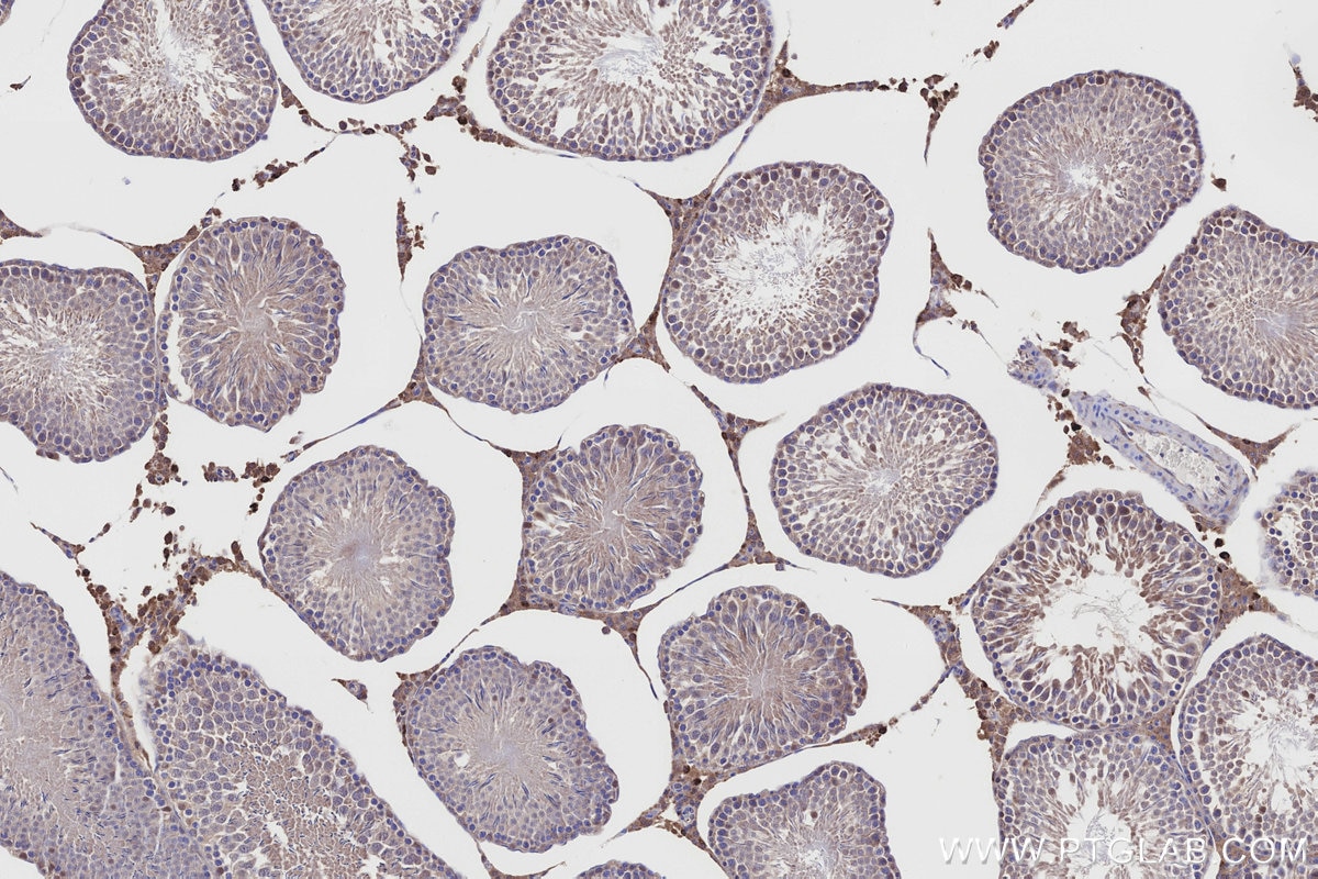 Immunohistochemistry (IHC) staining of rat testis tissue using NQO2 Polyclonal antibody (15767-1-AP)