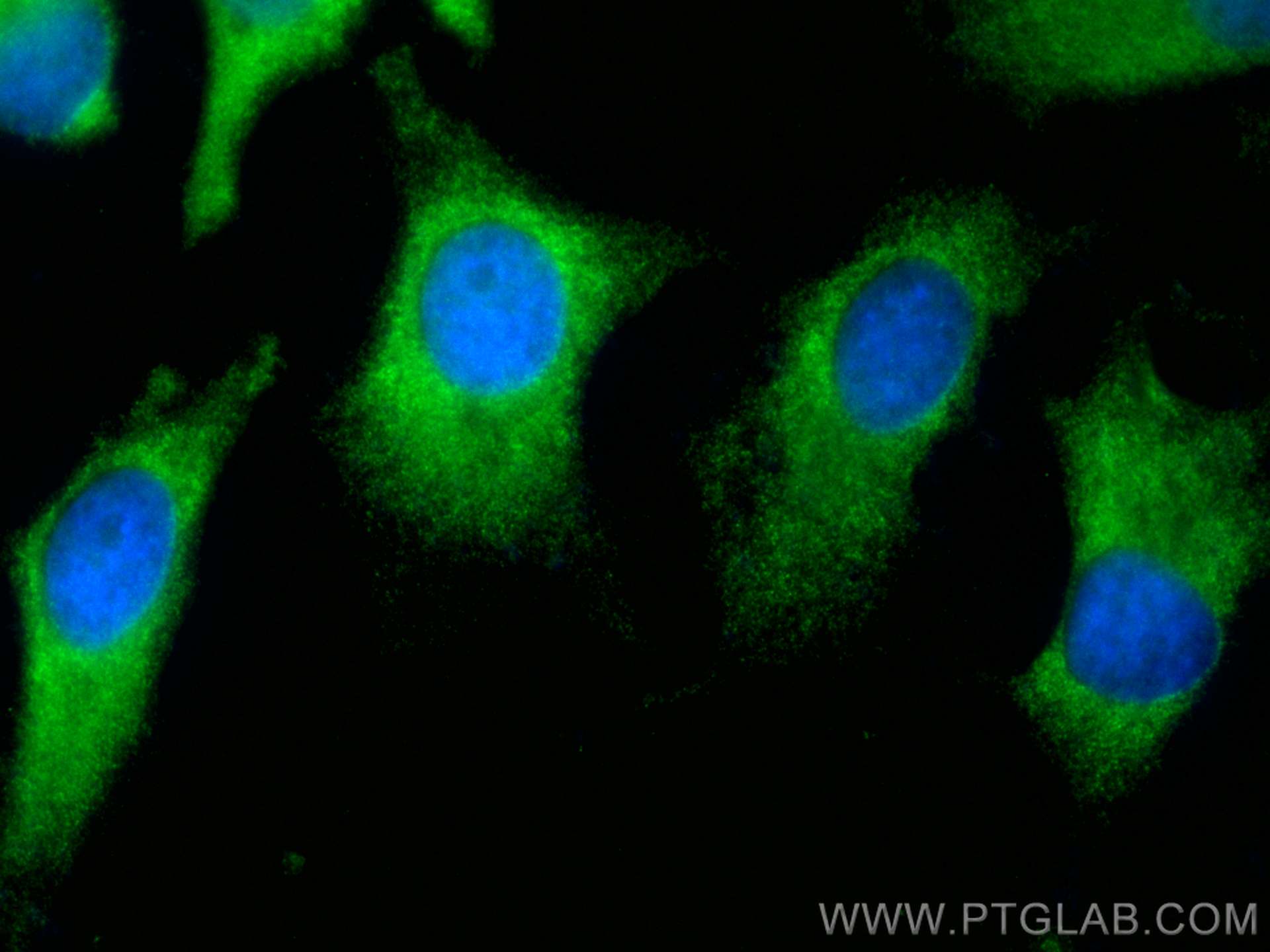 Immunofluorescence (IF) / fluorescent staining of HeLa cells using CoraLite® Plus 488-conjugated NQO2 Polyclonal anti (CL488-15767)