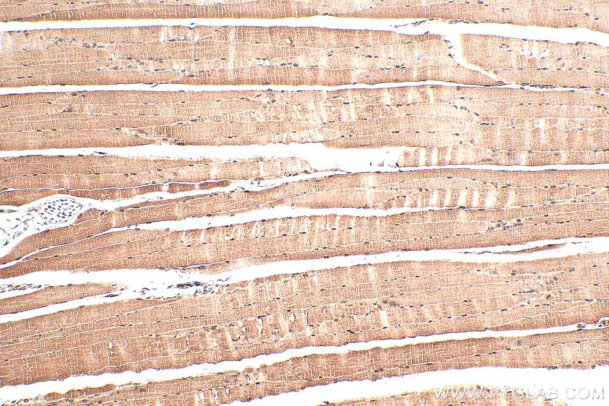 Immunohistochemistry (IHC) staining of mouse skeletal muscle tissue using NR1D1 Polyclonal antibody (14506-1-AP)