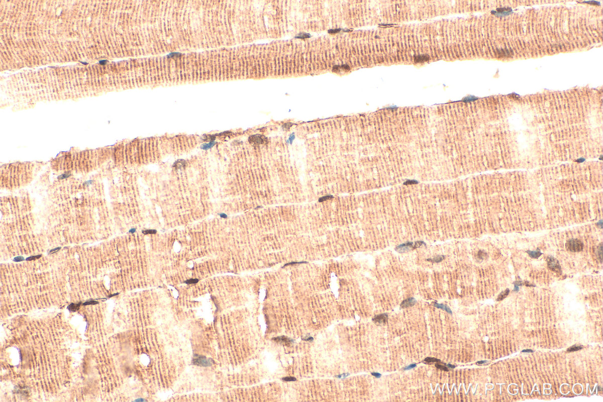 Immunohistochemistry (IHC) staining of mouse skeletal muscle tissue using NR1D1 Polyclonal antibody (14506-1-AP)
